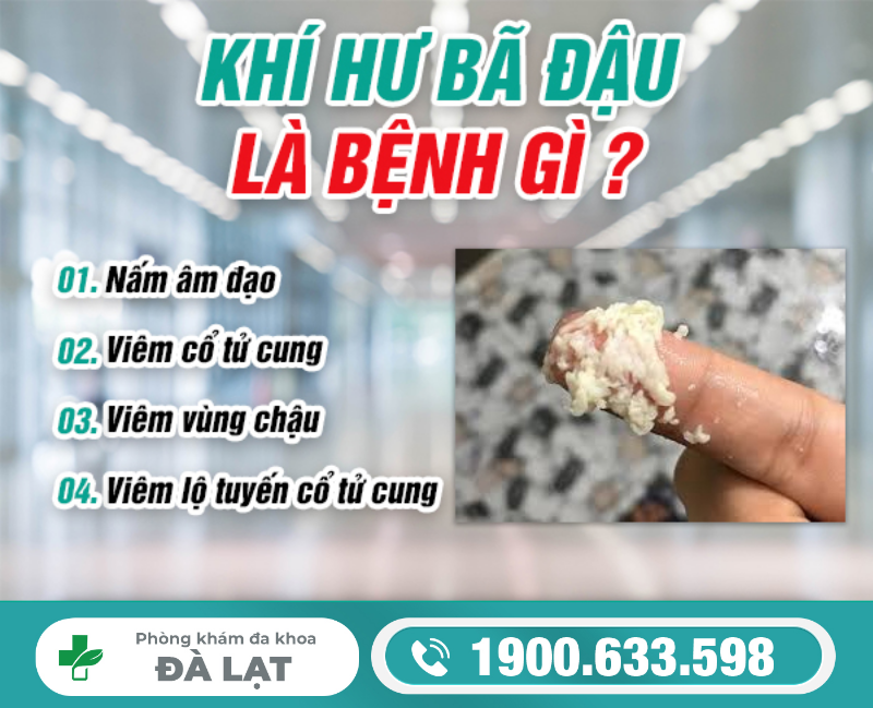 Hình ảnh minh họa